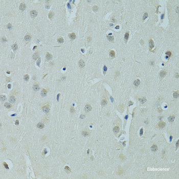 Immunohistochemistry of paraffin-embedded Rat kidney using SHH Polyclonal Antibody at dilution of 1:100 (40x lens).