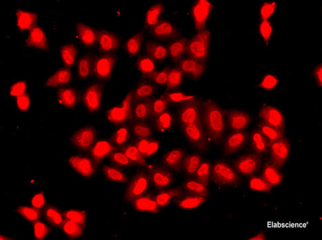 Immunohistochemistry of paraffin-embedded Mouse liver using SSX5 Polyclonal Antibody at dilution of 1:100 (40x lens).