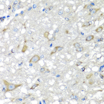 Immunohistochemistry of paraffin-embedded Human prostate using NCK2 Polyclonal Antibody at dilution of 1:100 (40x lens).