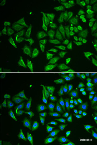 Immunohistochemistry of paraffin-embedded Rat kidney using DDX41 Polyclonal Antibody at dilution of 1:100 (40x lens).