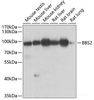 Immunofluorescence analysis of U2OS cells using ATP5F1 Polyclonal Antibody at dilution of 1:100. Blue: DAPI for nuclear staining.