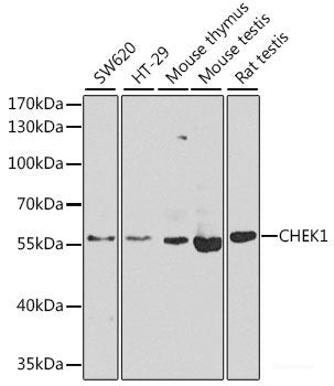 Immunofluorescence analysis of U2OS cells using REEP1 Polyclonal Antibody at dilution of 1:100. Blue: DAPI for nuclear staining.