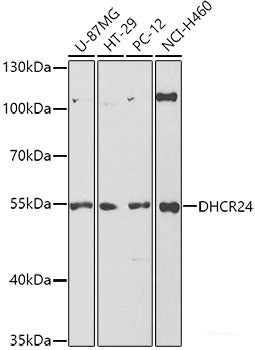 Immunohistochemistry of paraffin-embedded Rat kidney using GABARAP Polyclonal Antibody at dilution of 1:100 (40x lens).
