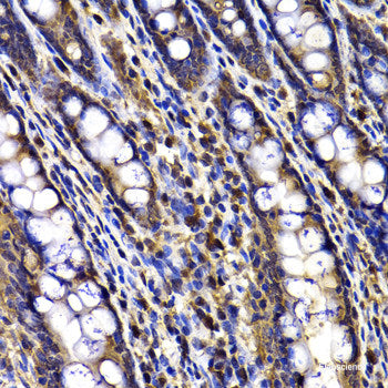 Immunofluorescence analysis of U2OS cells using HAUS8 Polyclonal Antibody at dilution of 1:100. Blue: DAPI for nuclear staining.