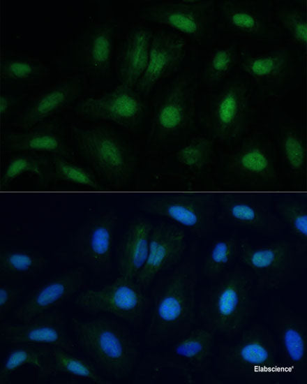 Immunohistochemistry of paraffin-embedded Human liver damage using SMAD9 Polyclonal Antibody at dilution of 1:100 (40x lens).