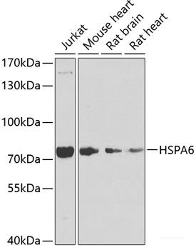 Immunohistochemistry of paraffin-embedded Rat ovary using ACAT2 Polyclonal Antibody at dilution of 1:100 (40x lens).