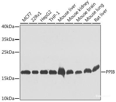 Immunohistochemistry of paraffin-embedded Rat brain using CDH16 Polyclonal Antibody at dilution of 1:100 (40x lens).