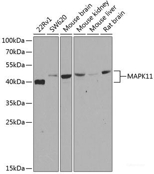 Immunofluorescence analysis of U2OS cells using EIF2B1 Polyclonal Antibody at dilution of 1:100. Blue: DAPI for nuclear staining.