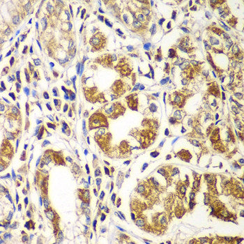 Immunohistochemistry of paraffin-embedded Human colon muscle using FLNA Polyclonal Antibody at dilution of 1:100 (40x lens).