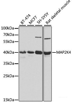 Immunohistochemistry of paraffin-embedded Rat brain using HTT Polyclonal Antibody at dilution of 1:100 (40x lens).