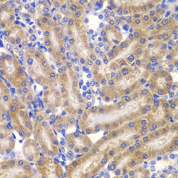 Immunohistochemistry of paraffin-embedded Human gastric using HRas Polyclonal Antibody at dilution of 1:100 (40x lens).