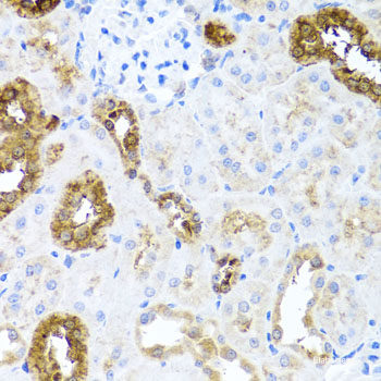 Immunofluorescence analysis of L929 cells using HSPA2 Polyclonal Antibody at dilution of 1:100. Blue: DAPI for nuclear staining.