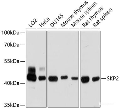 Immunofluorescence analysis of U2OS cells using IFNA6 Polyclonal Antibody at dilution of 1:100. Blue: DAPI for nuclear staining.