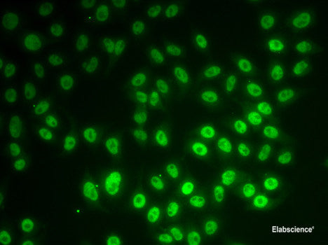 Immunohistochemistry of paraffin-embedded Rat brain using FASTKD1 Polyclonal Antibody at dilution of 1:100 (40x lens).