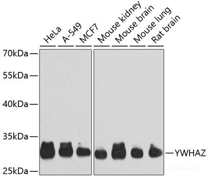 Immunofluorescence analysis of U2OS cells using PRMT6 Polyclonal Antibody at dilution of 1:100. Blue: DAPI for nuclear staining.