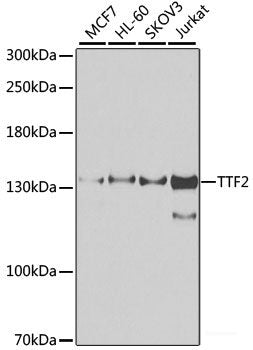 Immunohistochemistry of paraffin-embedded Human stomach using PSPH Polyclonal Antibody at dilution of 1:100 (40x lens).
