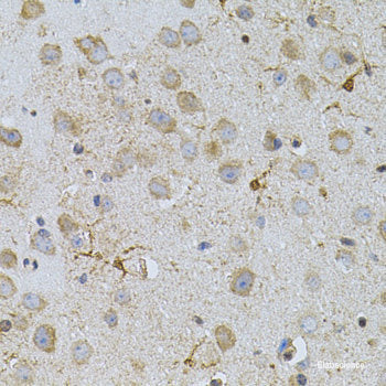 Immunofluorescence analysis of U2OS cells using TAF11 Polyclonal Antibody at dilution of 1:100. Blue: DAPI for nuclear staining.