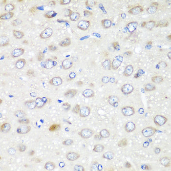 Immunohistochemistry of paraffin-embedded Mouse lung using KDM4A Polyclonal Antibody at dilution of 1:100 (40x lens).