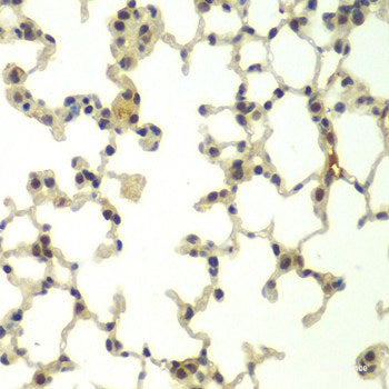 Immunohistochemistry of paraffin-embedded Mouse heart using MTX2 Polyclonal Antibody at dilution of 1:100 (40x lens).