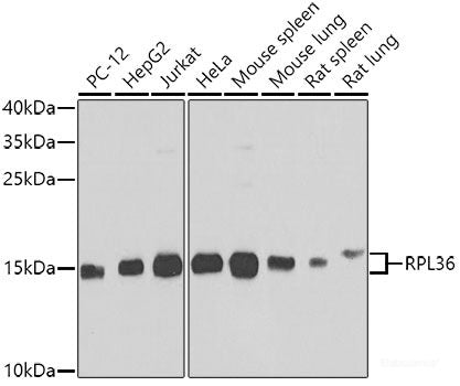 Immunohistochemistry of paraffin-embedded Human stomach using B9D1 Polyclonal Antibody at dilution of 1:100 (40x lens).