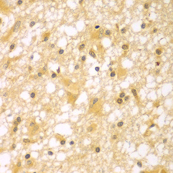 Immunohistochemistry of paraffin-embedded Human prostate using MCCC2 Polyclonal Antibody at dilution of 1:100 (40x lens).