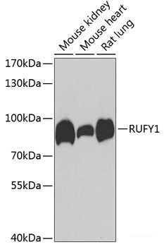 Immunofluorescence analysis of U2OS cells using SOCS4 Polyclonal Antibody at dilution of 1:100. Blue: DAPI for nuclear staining.