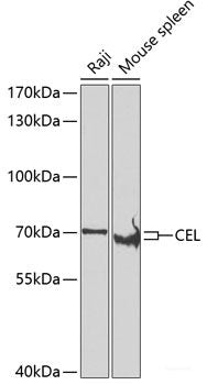 Immunohistochemistry of paraffin-embedded Rat brain using RAB17 Polyclonal Antibody at dilution of 1:100 (40x lens).