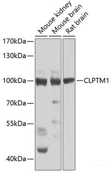 Immunofluorescence analysis of U2OS cells using FERMT3 Polyclonal Antibody at dilution of 1:100. Blue: DAPI for nuclear staining.