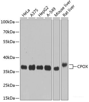 Confocal immunofluorescence analysis of U2OS cells using SF3A3 Polyclonal Antibody at dilution of 1:100. Blue: DAPI for nuclear staining.