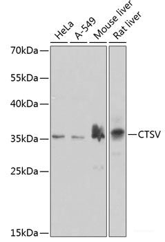 Immunofluorescence analysis of U2OS cells using ATG4D Polyclonal Antibody at dilution of 1:100. Blue: DAPI for nuclear staining.