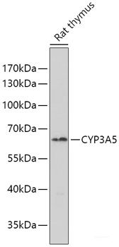 Immunohistochemistry of paraffin-embedded Human liver cancer using ALG2 Polyclonal Antibody at dilution of 1:100 (40x lens).