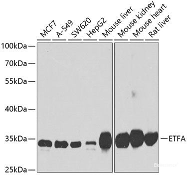 Immunohistochemistry of paraffin-embedded Human kidney using TGS1 Polyclonal Antibody at dilution of 1:100 (40x lens).