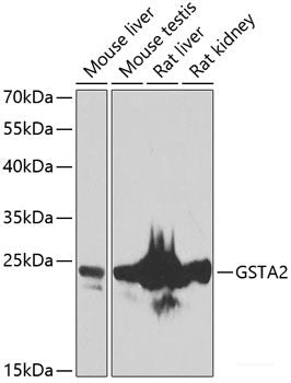 Immunohistochemistry of paraffin-embedded Human stomach using SPICE1 Polyclonal Antibody at dilution of 1:100 (40x lens).