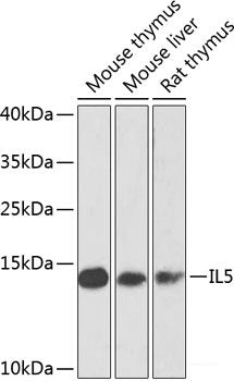 Immunofluorescence analysis of HeLa cells using ACVR2B Polyclonal Antibody at dilution of 1:100 (40x lens). Blue: DAPI for nuclear staining.