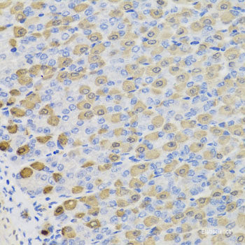 Immunofluorescence analysis of U2OS cells using COG4 Polyclonal Antibody at dilution of 1:100. Blue: DAPI for nuclear staining.