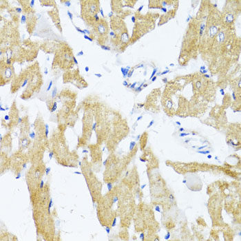 Immunohistochemistry of paraffin-embedded Human stomach using ALKBH4 Polyclonal Antibody at dilution of 1:100 (40x lens).
