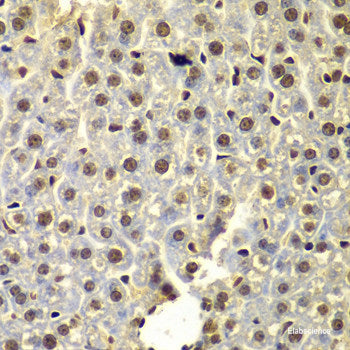 Immunofluorescence analysis of U-2 OS cells using ITPR1 Polyclonal Antibody at dilution of 1:100. Blue: DAPI for nuclear staining.