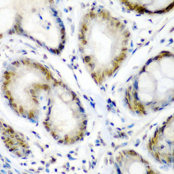 Immunohistochemistry of paraffin-embedded Rat spleen using UBASH3B Polyclonal Antibody at dilution of 1:100 (40x lens).