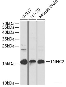 Immunohistochemistry of paraffin-embedded Human colon using MTX1 Polyclonal Antibody at dilution of 1:100 (40x lens).