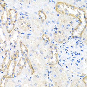 Immunohistochemistry of paraffin-embedded Human brain cancer using OCT4 Polyclonal Antibody at dilution of 1:100 (40x lens).