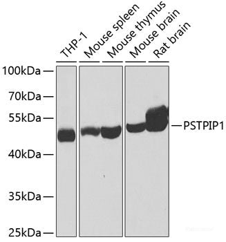 Immunohistochemistry of paraffin-embedded Mouse lung using WHSC1 Polyclonal Antibody at dilution of 1:100 (40x lens).