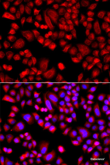 Immunohistochemistry of paraffin-embedded Mouse stomach using IRS2 Polyclonal Antibody at dilution of 1:100 (40x lens).