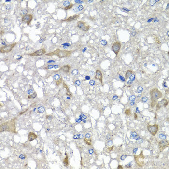 Immunohistochemistry of paraffin-embedded Rat brain using GABARAPL2 Polyclonal Antibody at dilution of 1:200 (40x lens).