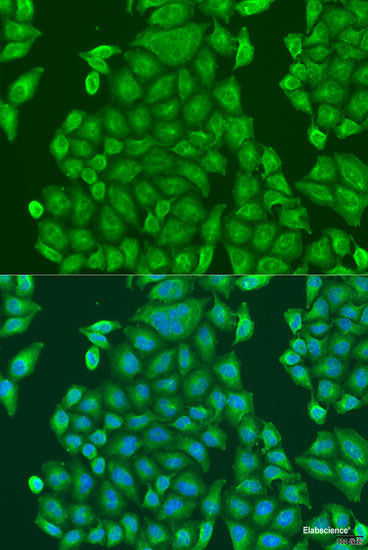 Immunofluorescence analysis of U2OS cells using MLH3 Polyclonal Antibody at dilution of 1:100. Blue: DAPI for nuclear staining.