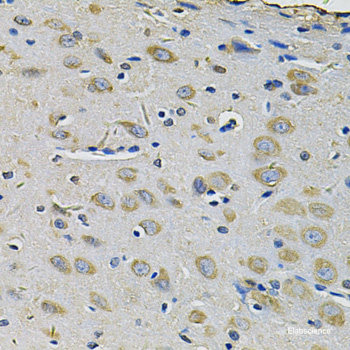 Immunofluorescence analysis of U2OS cells using EGLN3 Polyclonal Antibody at dilution of 1:100. Blue: DAPI for nuclear staining.