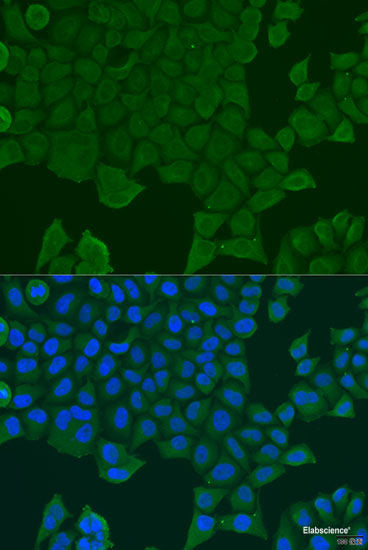 Immunohistochemistry of paraffin-embedded Human stomach using EFHC1 Polyclonal Antibody at dilution of 1:100 (40x lens).