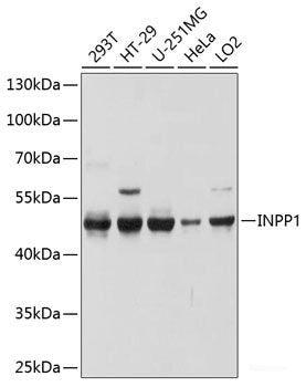 Immunofluorescence analysis of HeLa cells using BCL2L13 Polyclonal Antibody