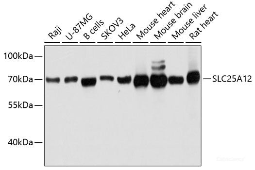 Western blot analysis of extracts of Mouse spleen using MKLN1 Polyclonal Antibody at dilution of 1:3000.