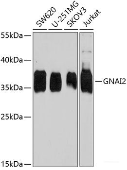 Immunohistochemistry of paraffin-embedded Rat brain using VPS37A Polyclonal Antibody at dilution of 1:100 (40x lens).