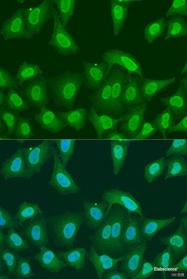 Immunohistochemistry of paraffin-embedded Human kidney using CALCOCO1 Polyclonal Antibody at dilution of 1:100 (40x lens).